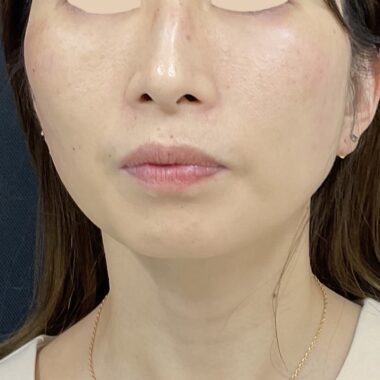 After