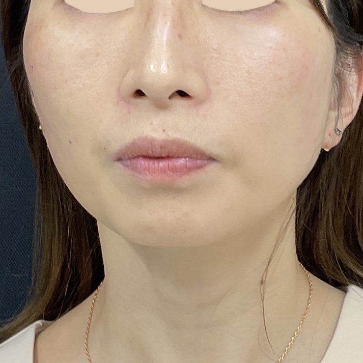 After