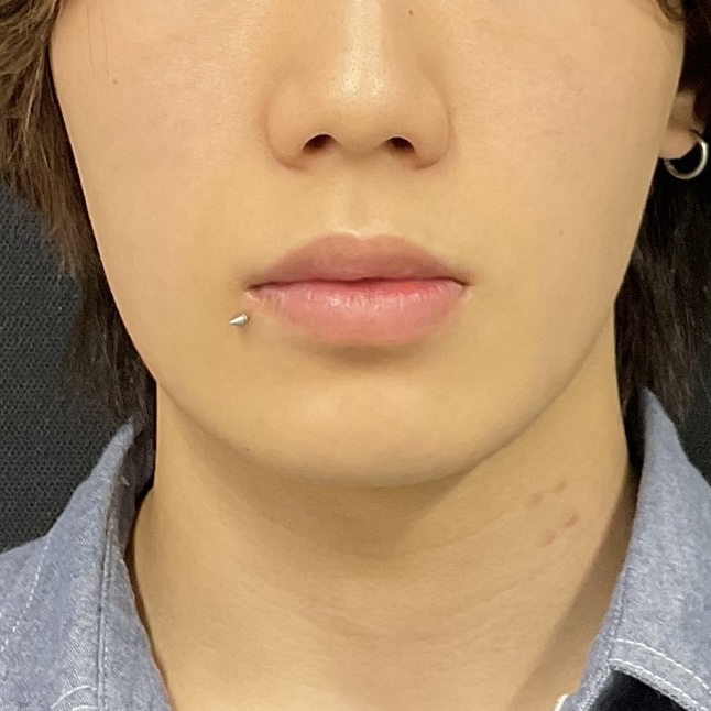 Before