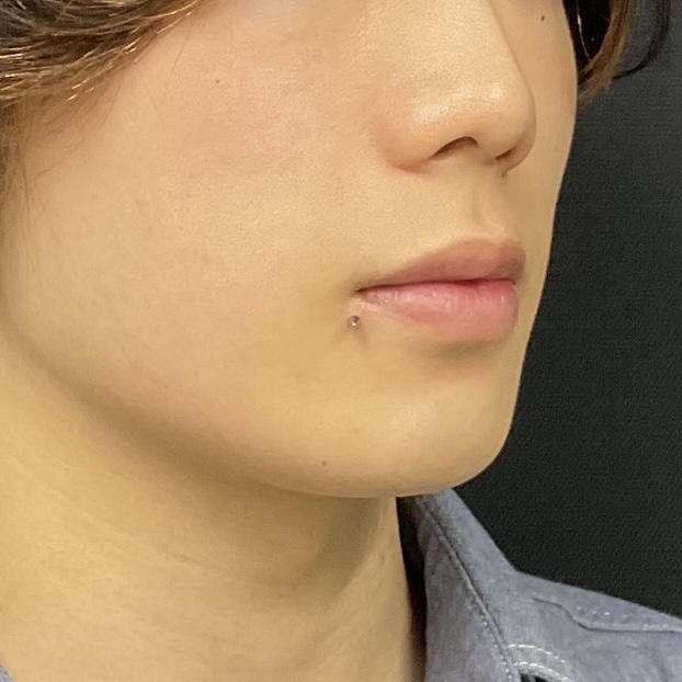 Before