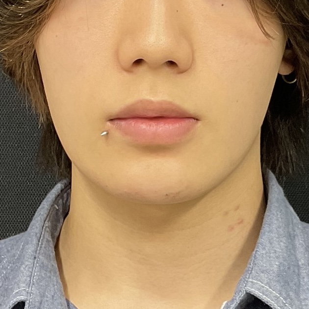 After