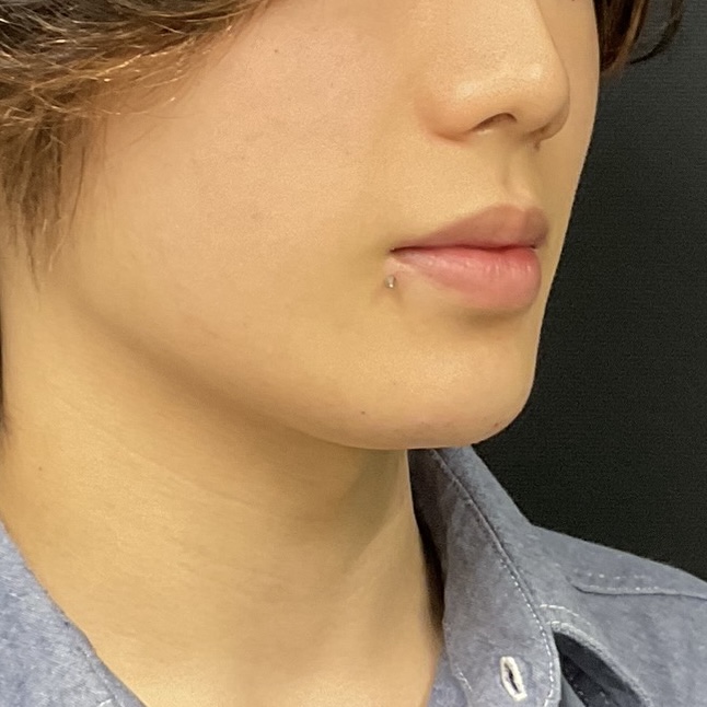 After