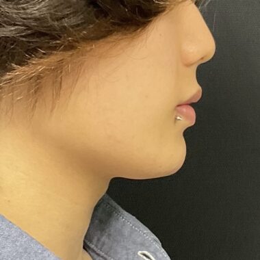 After