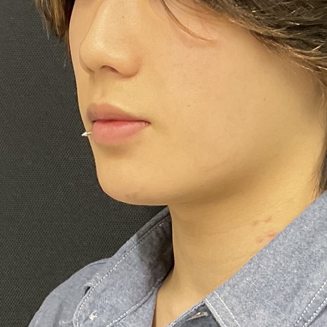 After