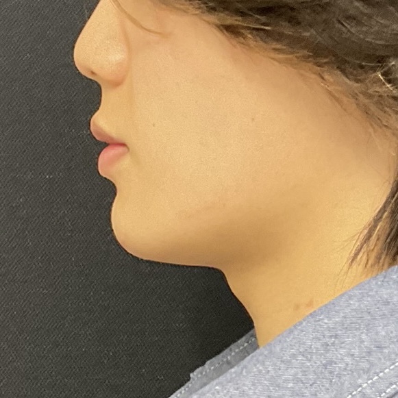 After