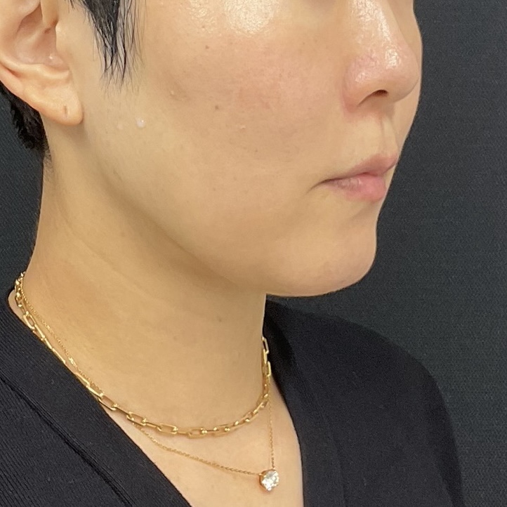 After