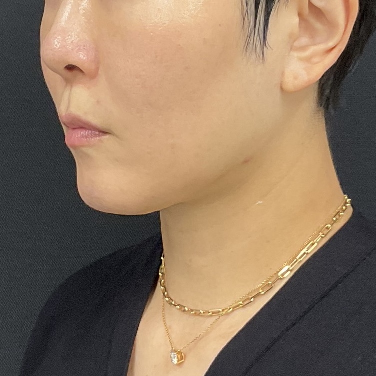 After