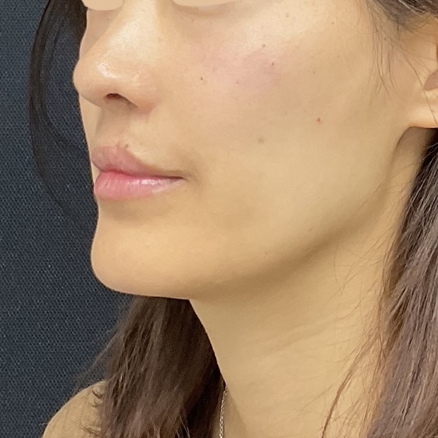 After