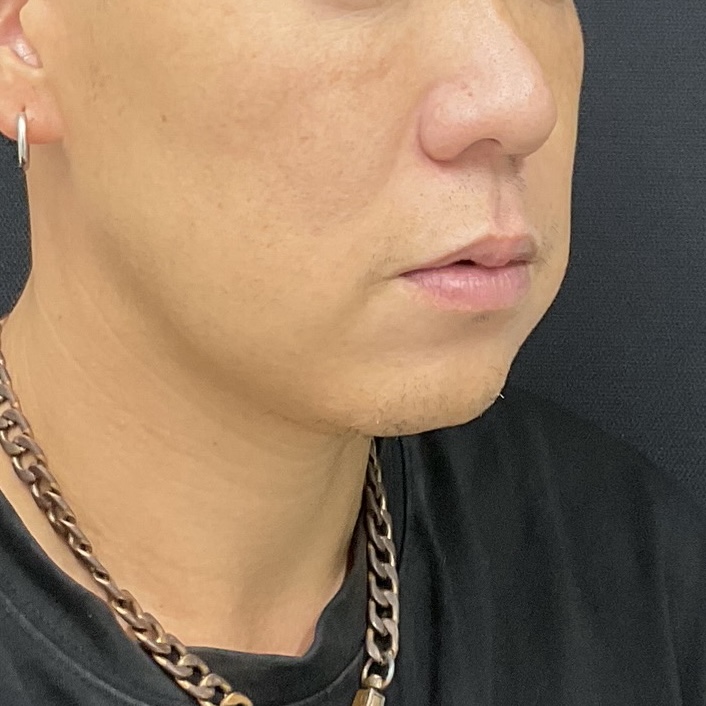 After