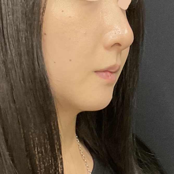 After