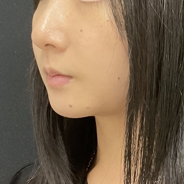 After