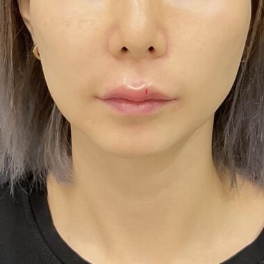 After