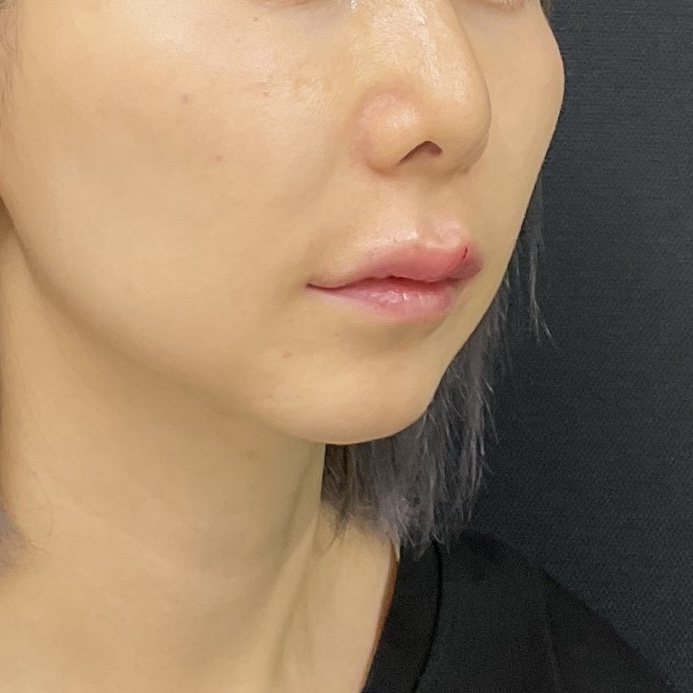 After