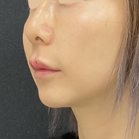After