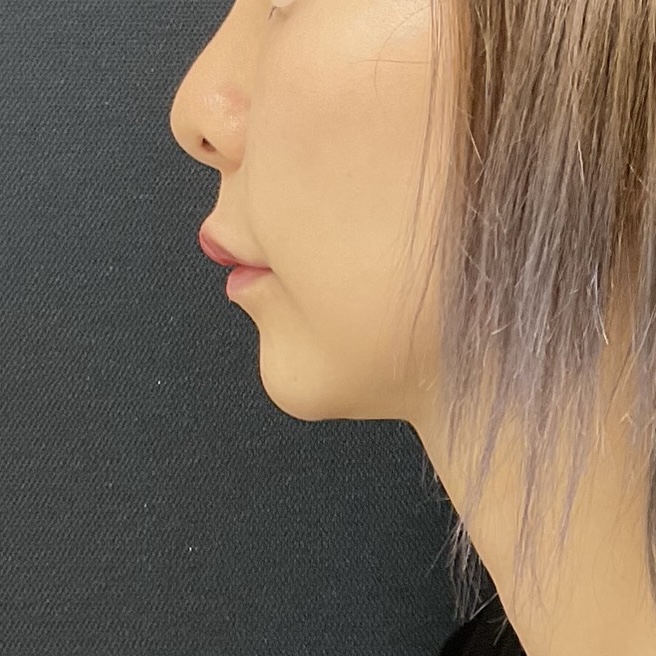 After