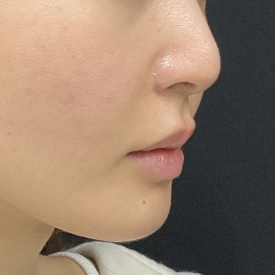 Before