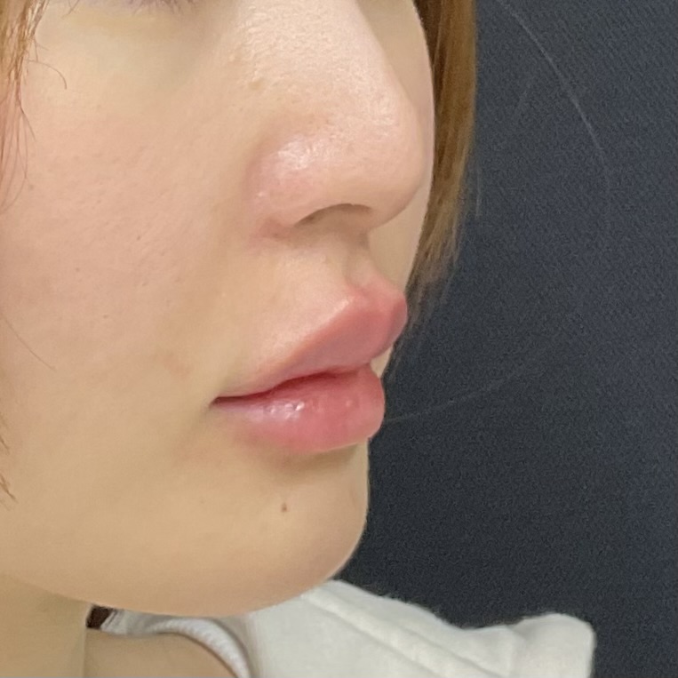 After