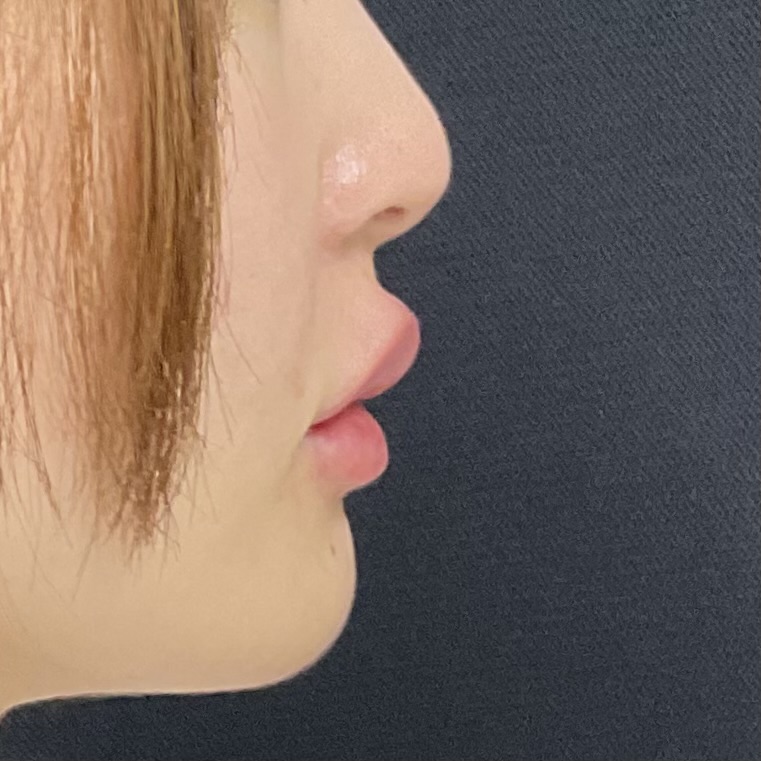 After