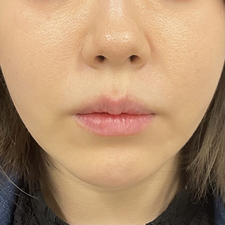 Before