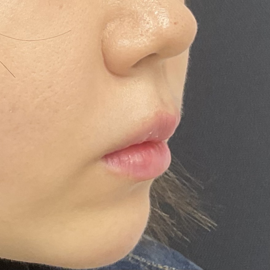Before