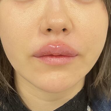 After