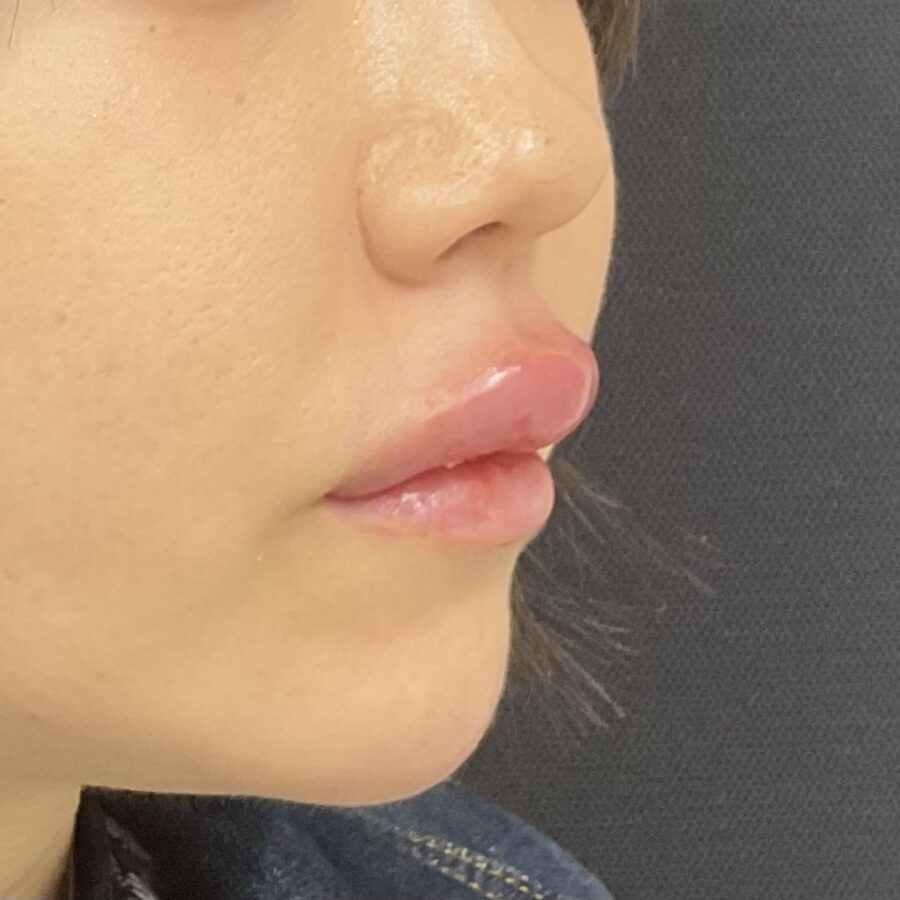After
