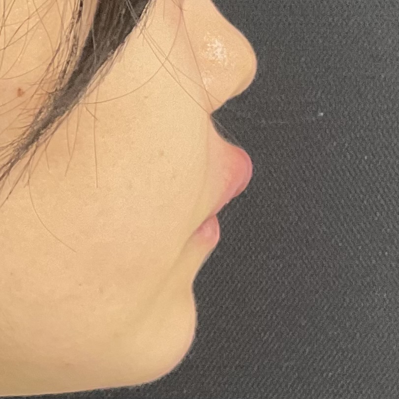 After