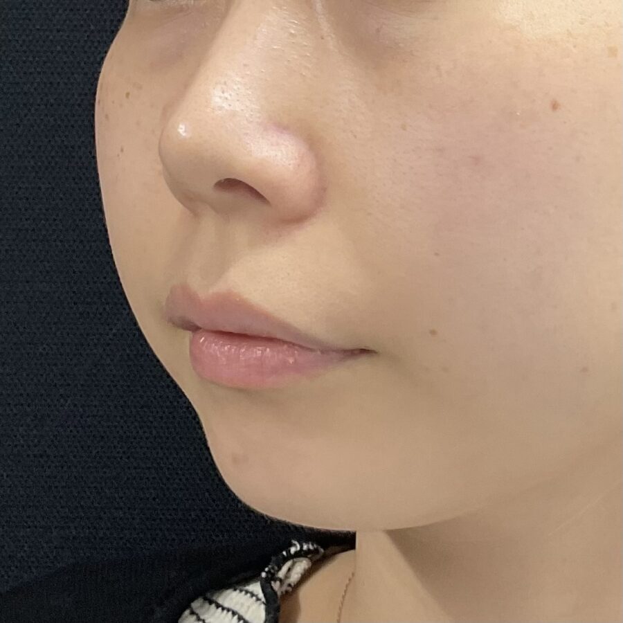 Before