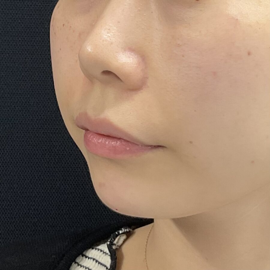 After