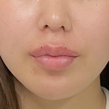 After
