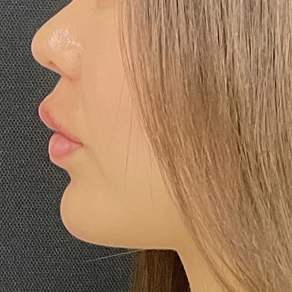 After