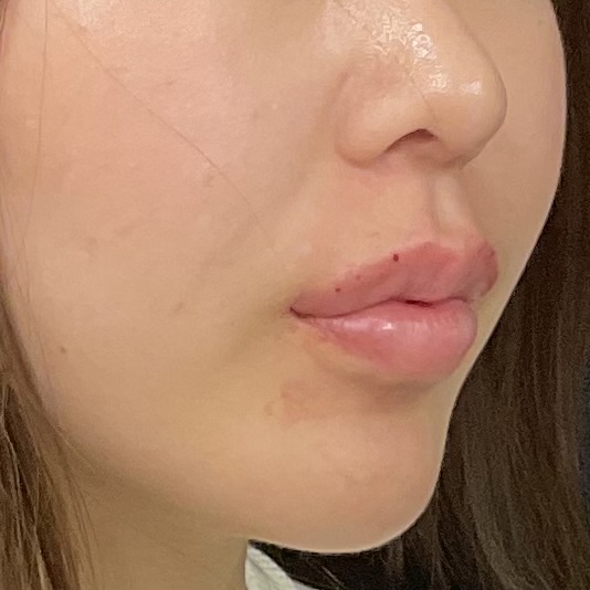 After