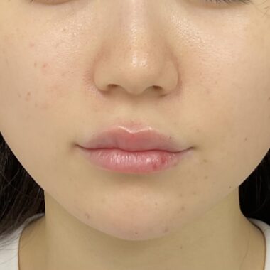 After