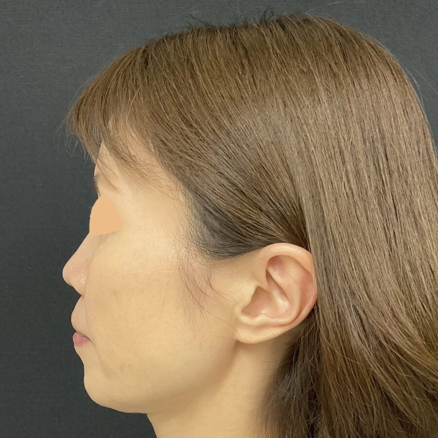 After